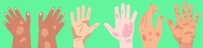 Un'immagine generica segnaposto con angoli arrotondati in una figura.